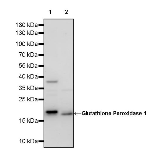 Glutathione Peroxidase 1 Recombinant Rabbit mAb (S-1714-17)