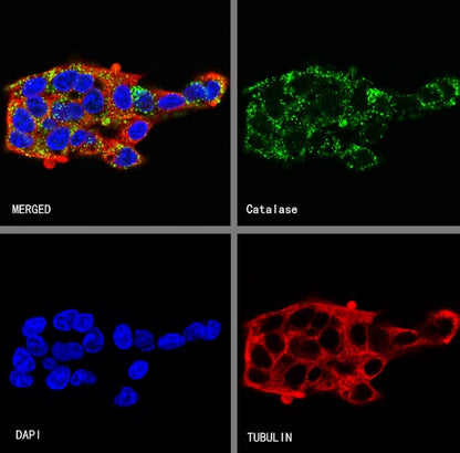 Catalase Recombinant Rabbit mAb (S-1925-3)