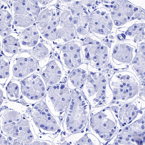S-RMab® Cadherin 17 Recombinant Rabbit mAb (SDT-736-23)