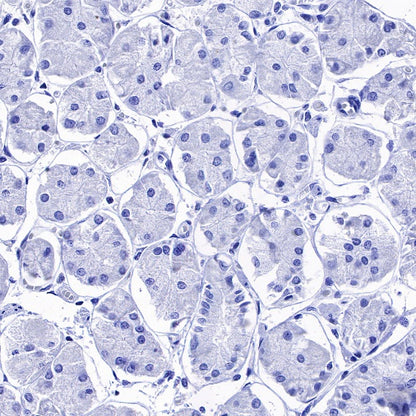S-RMab® Cadherin 17 Recombinant Rabbit mAb (SDT-736-23)