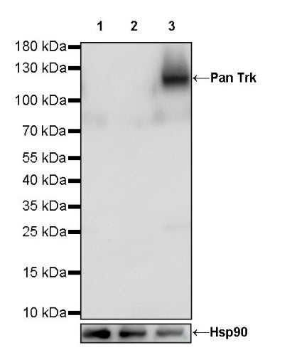 Pan Trk Recombinant Rabbit mAb (SDT-400-39)
