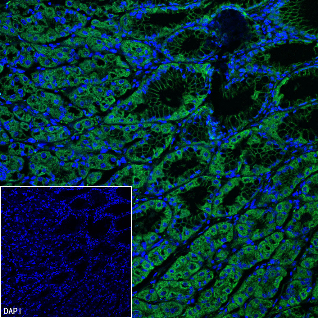 Vinculin Recombinant Rabbit mAb (S-5405)