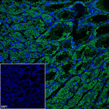 Vinculin Recombinant Rabbit mAb (S-5405)