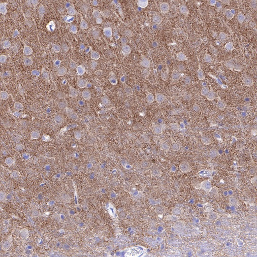 α-Synuclein Recombinant Rabbit mAb (S-441-86)