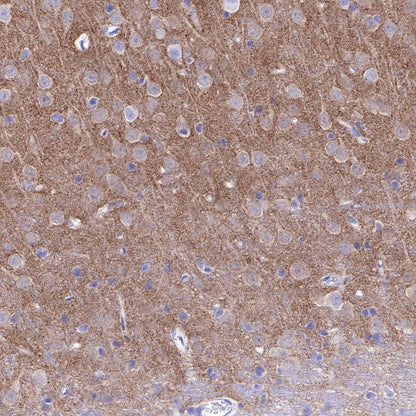 α-Synuclein Recombinant Rabbit mAb (S-441-86)