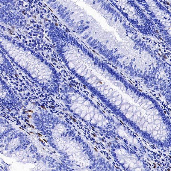 ZEB1 Recombinant Rabbit mAb