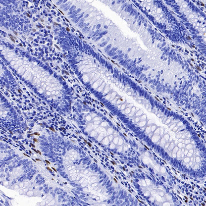 ZEB1 Recombinant Rabbit mAb