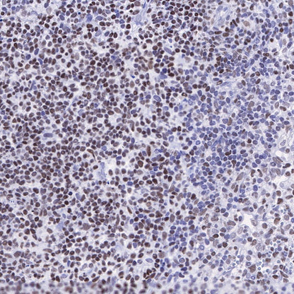 PFKFB3 Recombinant Rabbit mAb (S-653-35)