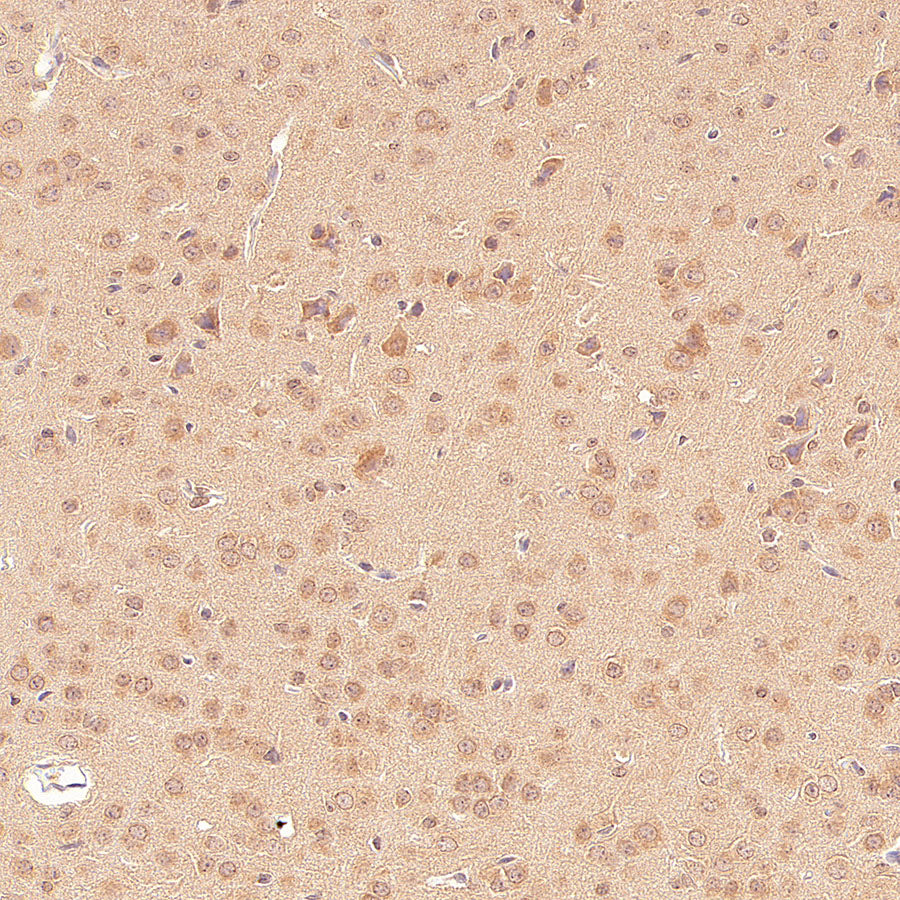 GABA A Receptor alpha 5/GABRA5 Recombinant Rabbit mAb (S-6030)
