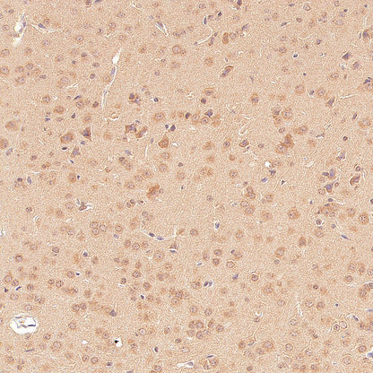 GABA A Receptor alpha 5/GABRA5 Recombinant Rabbit mAb (S-6030)