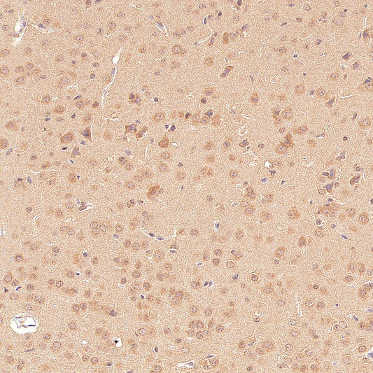GABA A Receptor alpha 5/GABRA5 Recombinant Rabbit mAb (S-6030)