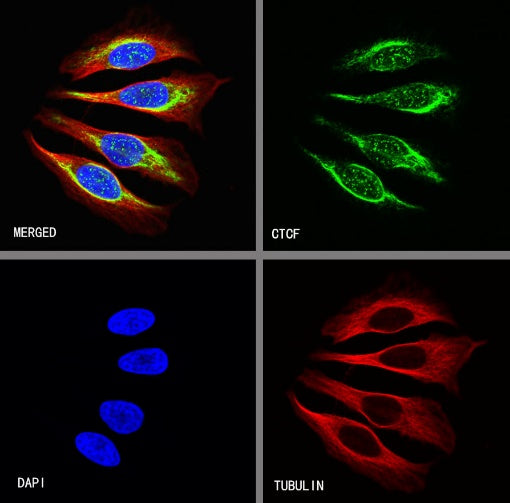 CTCF Recombinant Rabbit mAb (S-924-14)