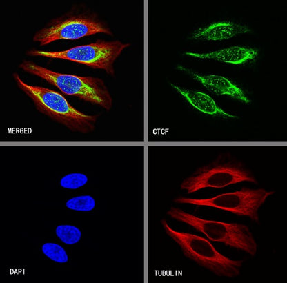 CTCF Recombinant Rabbit mAb (S-924-14)