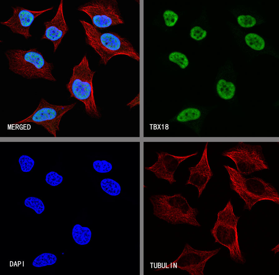 TBX18 Recombinant Rabbit mAb (S-4619-17)