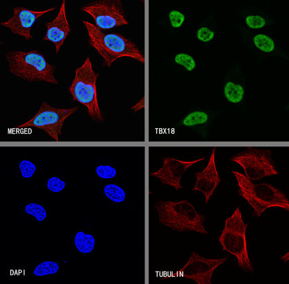 TBX18 Recombinant Rabbit mAb (S-4619-17)