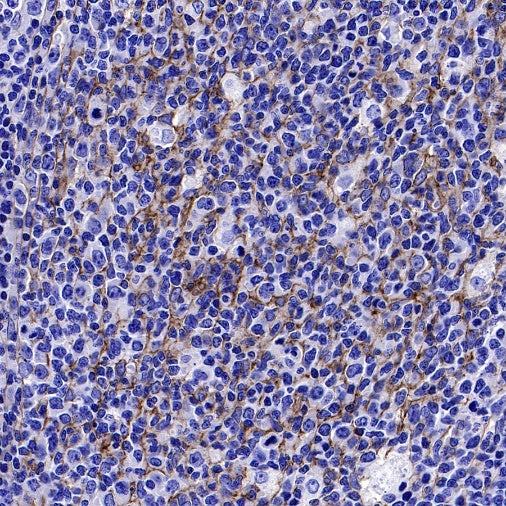B7-H3 Recombinant Rabbit mAb (SDT-1333-8)