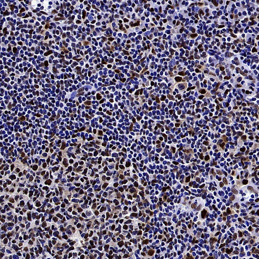 HAT1 Recombinant Rabbit mAb (S-2429-14)