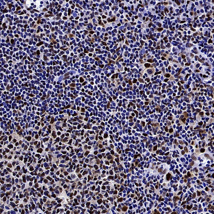 HAT1 Recombinant Rabbit mAb (S-2429-14)