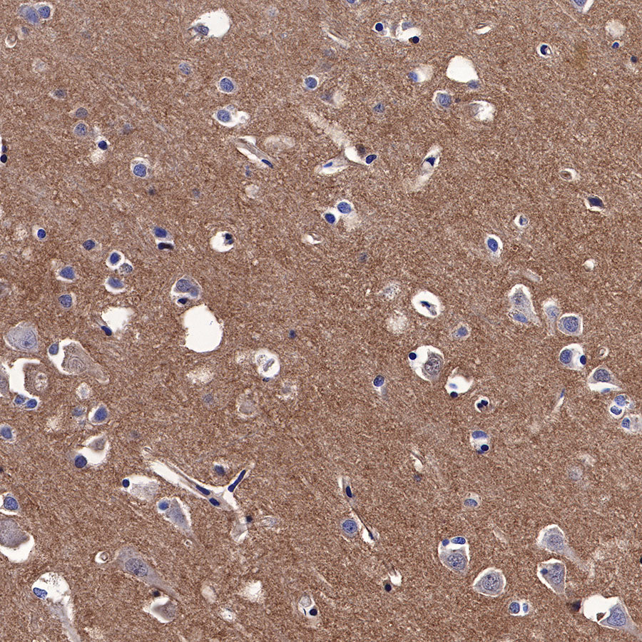 N-Cadherin Recombinant Rabbit mAb (SDT-329-12)