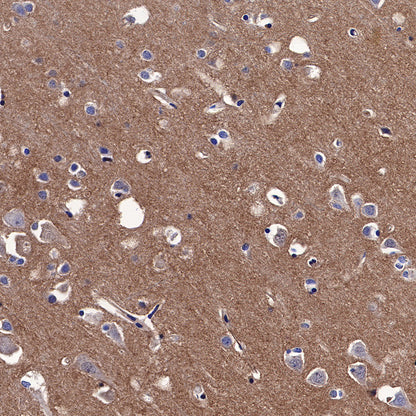 N-Cadherin Recombinant Rabbit mAb (SDT-329-12)