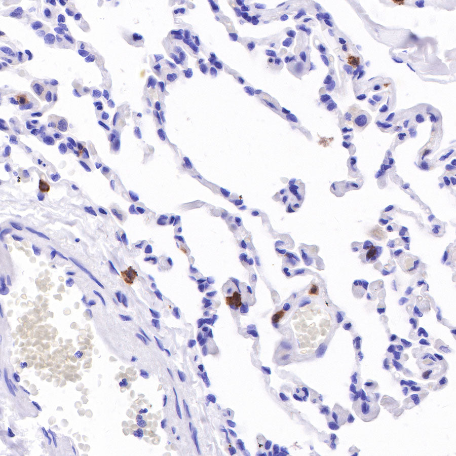 CD103 Recombinant Rabbit mAb (SDT-R134)