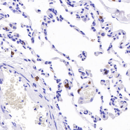 CD103 Recombinant Rabbit mAb (SDT-R134)