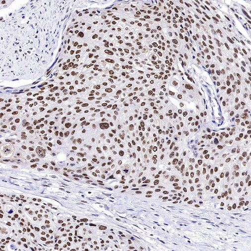 RPA70 Recombinant Rabbit mAb (S-1653-9)