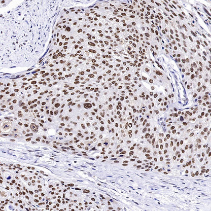 RPA70 Recombinant Rabbit mAb (S-1653-9)