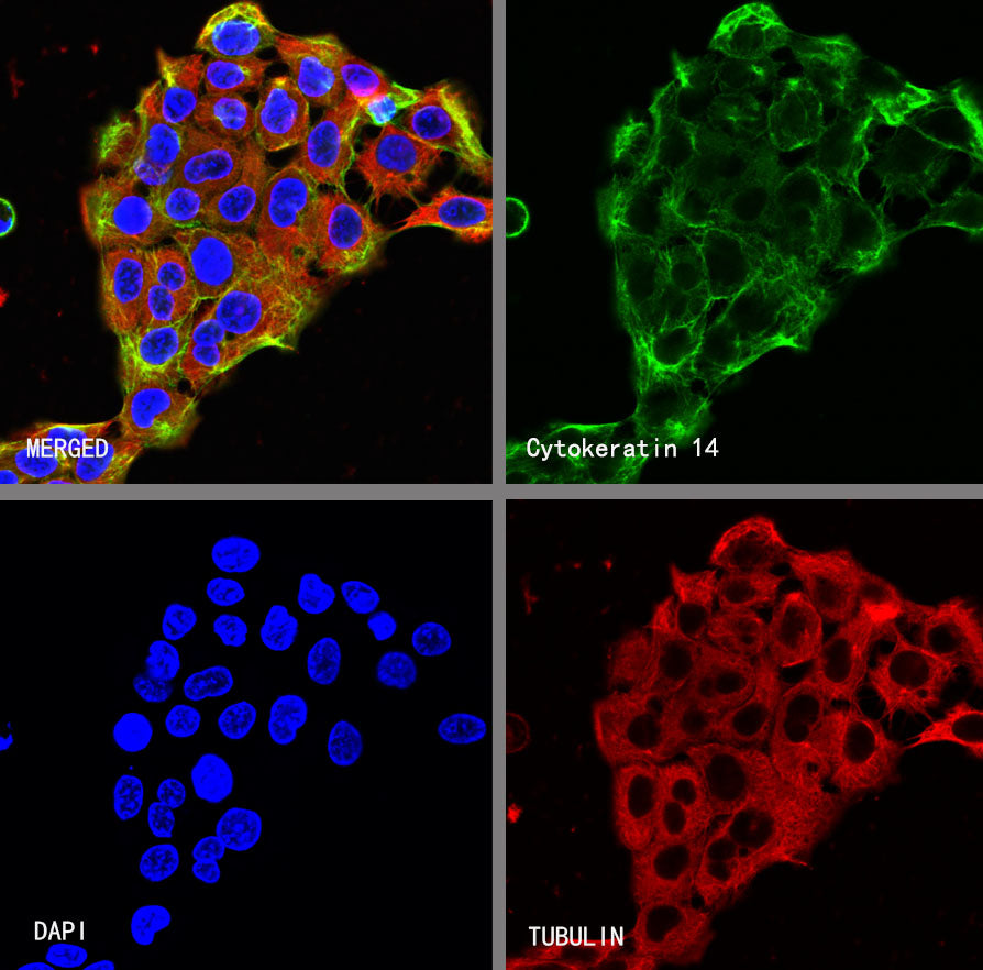Cytokeratin 14 Recombinant Mouse mAb (S-M0003)