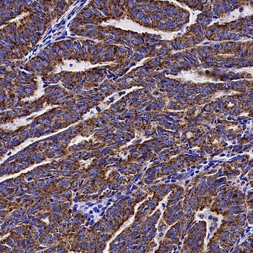 TOM20 Recombinant Rabbit mAb (SDT-2553-11)