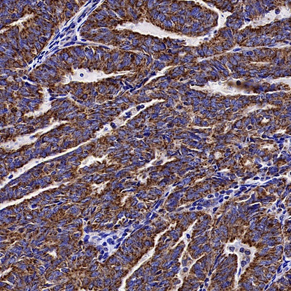 TOM20 Recombinant Rabbit mAb (SDT-2553-11)