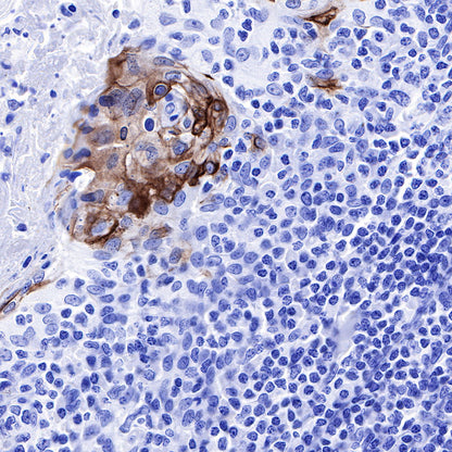 Keratin 10 Recombinant Rabbit mAb (SDT-124-6)