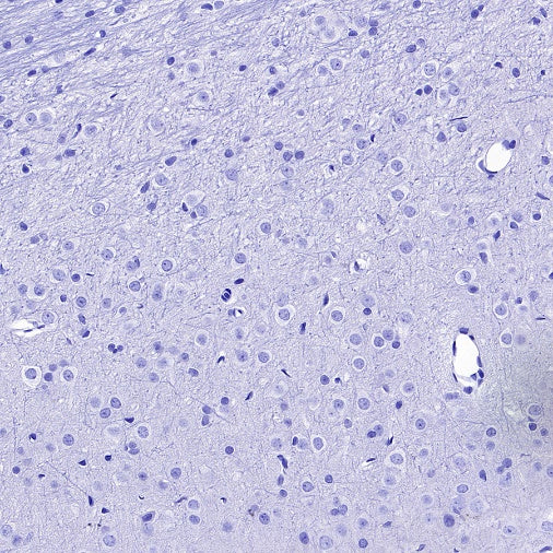 Lipocalin-2/NGAL Recombinant Rabbit mAb (S-2280-129)