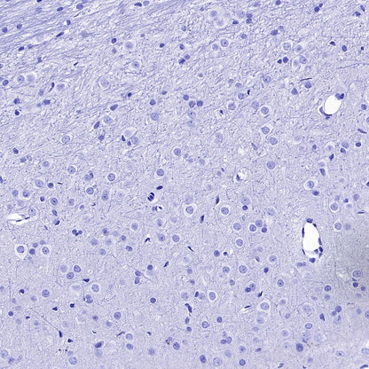 Lipocalin-2/NGAL Recombinant Rabbit mAb (S-2280-129)
