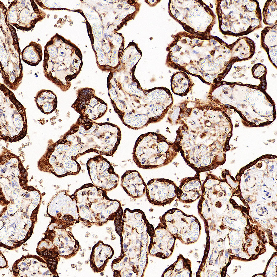 P4HB Recombinant Rabbit mAb