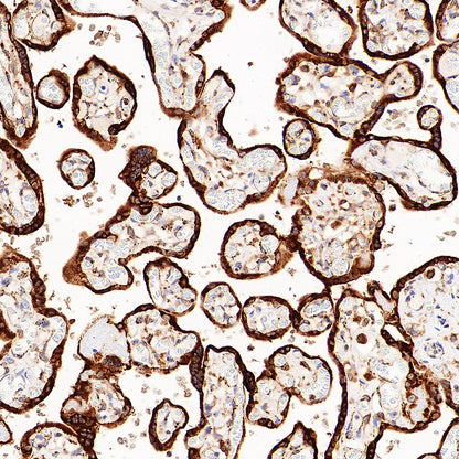 P4HB Recombinant Rabbit mAb