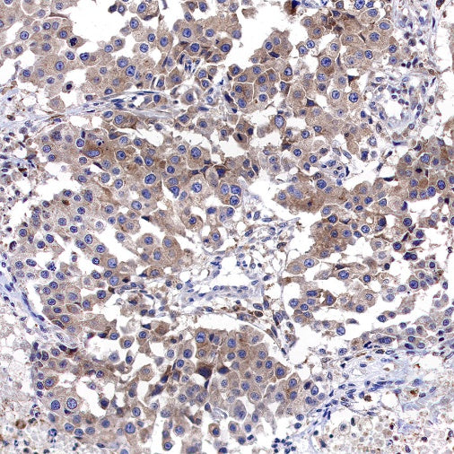 CAD/BM1 Recombinant Rabbit mAb (S-1650-21)
