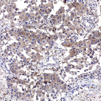 CAD/BM1 Recombinant Rabbit mAb (S-1650-21)