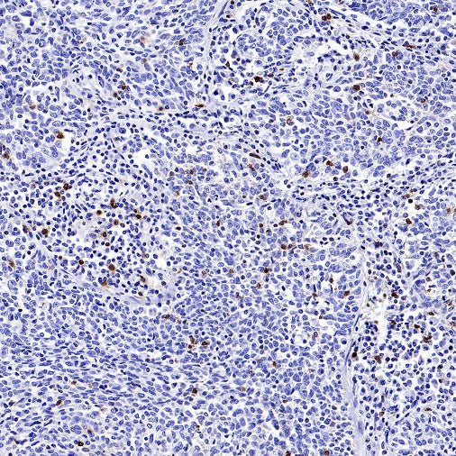 CD94 Recombinant Rabbit mAb (S-2616-5)