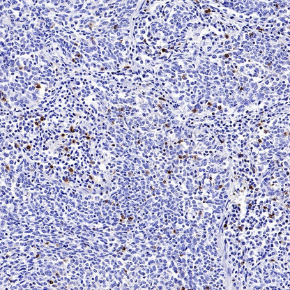 CD94 Recombinant Rabbit mAb (S-2616-5)