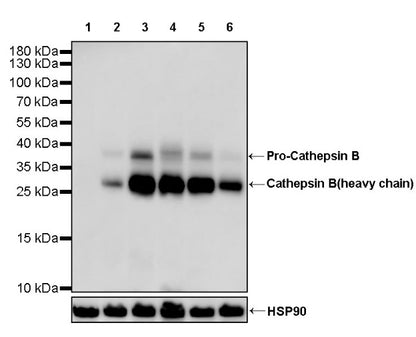Cathepsin B Recombinant Rabbit mAb (S-1067-7)