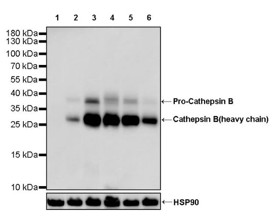 Cathepsin B Recombinant Rabbit mAb (S-1067-7)