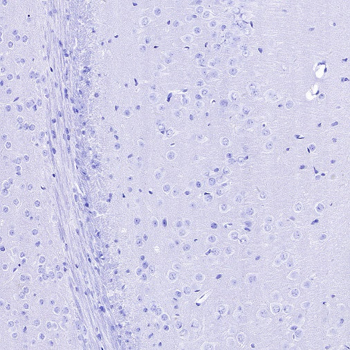 Myelin protein zero Recombinant Rabbit mAb (SDT-1225-8)