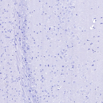 Myelin protein zero Recombinant Rabbit mAb (SDT-1225-8)