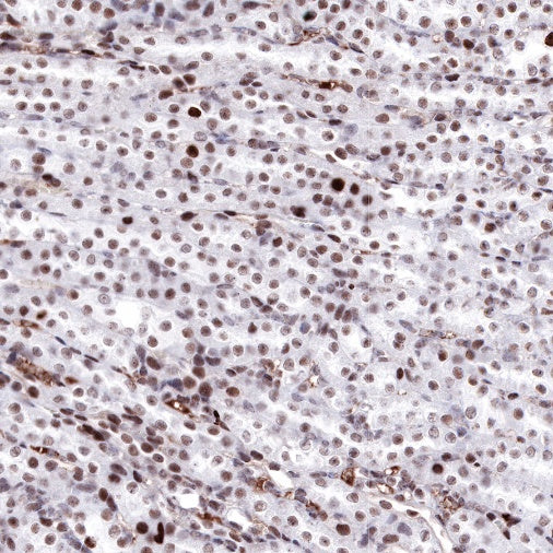 Propionyl-Histone H4 (Lys5) Recombinant Rabbit mAb (S-R093)