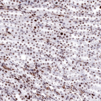 Propionyl-Histone H4 (Lys5) Recombinant Rabbit mAb (S-R093)