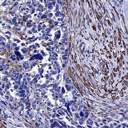 Phospho-Vimentin (Ser39) Rabbit Polyclonal Antibody