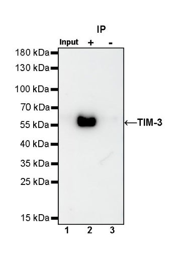 TIM-3 Recombinant Rabbit mAb (S-1450-21)