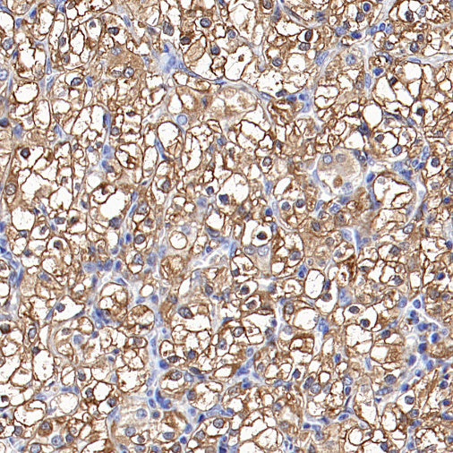 Ferritin Light Chain Recombinant Rabbit mAb (S-1879-19)