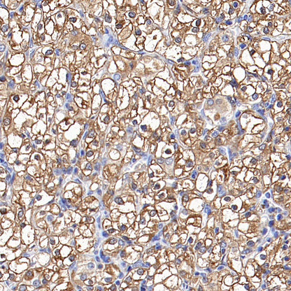 Ferritin Light Chain Recombinant Rabbit mAb (S-1879-19)